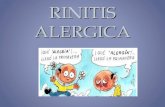 RINITIS ALERGICA. La rinitis alérgica es una enfermedad sintomática de la nariz que produce por una inflamación de la mucosa. Es mediada por IgE e inducida.