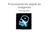Procesamiento digital de Imágenes Tomografía. Introducción Uso mas frecuente en medicina Acústica Microondas Geología Microscopios electrónicos Radiotelescopios.