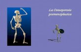 La Osteoporosis posmenopáusica. ¿Qué es la Osteoporosis ? Literalmente quiere decir “Hueso Poroso”