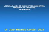 LECTURA BASICA DE UN ELECTROCARDIOGRAMA Y PRINCIPALES SINDROMES VALVULARES Dr. Juan Ricardo Cortés - 2014.