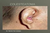 COLESTEATOMA Dr. Ramón Paz Campos. TOPOGRAFIA DEL OIDO MEDIO  Cavidad situada dentro del peñasco del temporal, separada del oído externo por la membrana.