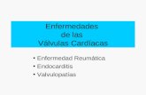 Enfermedades de las Válvulas Cardíacas Enfermedad Reumática Endocarditis Valvulopatías.