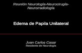 Edema de Papila Unilateral Reunión Neurología-Neurocirugía- Neurorradiología Juan Carlos Casar Residente de Neurología.