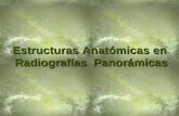 Estructuras Anatómicas en Radiografías Panorámicas.