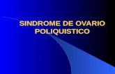 SINDROME DE OVARIO POLIQUISTICO. GENERALIDADES El SOP es causa de amenorrea y anovulación. En su forma clásica se caracteriza por infertilidad, oligo.
