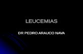 LEUCEMIAS DR PEDRO ARAUCO NAVA.
