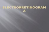 ELECTRORRETINOGRAMA ERG es una prueba de diagnóstico usada en todo el mundo para evaluar la capacidad funcional de los fotorreceptores sensibles a la.