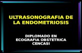 ULTRASONOGRAFIA DE LA ENDOMETRIOSIS DIPLOMADO EN ECOGRAFIA OBSTETRICA CENCASI.