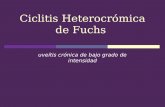 Ciclitis Heterocrómica de Fuchs uveítis crónica de bajo grado de intensidad.