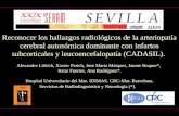 Reconocer los hallazgos radiológicos de la arteriopatía cerebral autosómica dominante con infartos subcorticales y leucoencefalopatía (CADASIL). Alexandre.