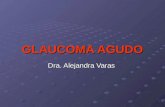 GLAUCOMA AGUDO Dra. Alejandra Varas. Glaucoma Agudo Glaucoma Agudo con Cierre Angular Emergencia oftalmológica que requiere diagnóstico y solución rápida.