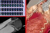 Nuevas estrategias en imagen cardiovascular para reducir la exposición a radiación Dr. Erick Alexanderson Rosas.