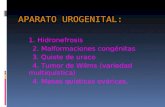 APARATO UROGENITAL: 1. Hidronefrosis 2. Malformaciones congénitas 3. Quiste de uraco 4. Tumor de Wilms (variedad multiquística) 4. Masas quísticas ováricas.