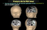 Futuro de la RM fetal Nuevas secuencias 3D del neonato aplicables al feto: 3D SPGR T1 para el estudio cortical.