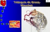 Tri á ngulo de Brocq- Mouchet Tri á ngulo de Brocq- Mouchet.