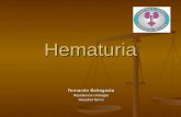 Hematuria Fernando Bañagasta Residencia Urología Hospital Tornú.