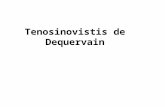 Tenosinovistis de Dequervain. La tendinitis de DeQuervain es una condición que se genera por irritación e inflamación de la vaina sinovial que envuelve.