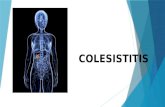 COLESISTITIS. COLESISTITIS AGUDA Es una hinchazón e irritación repentina de la vesícula biliar que causa dolor abdominal intenso.