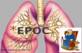 Ruth Sarantes Dávila. * La Enfermedad Pulmonar Obstructiva Crónica (EPOC) se define actualmente como una patología prevenible y tratable, caracterizada.