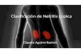 Clasificación de Nefritis Lúpica Claudia Aguirre Ramón.