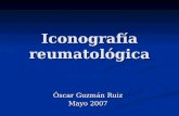 Iconografía reumatológica Óscar Guzmán Ruiz Mayo 2007.