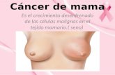 Cáncer de mama Es el crecimiento desenfrenado de las células malignas en el tejido mamario.( seno)