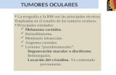 TUMORES OCULARES La ecografía y la RM son las principales técnicas Empleadas en el estudio de los tumores oculares. Principales entidades: Melanoma coroideo.