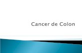 Cancer  de Colon