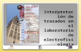 Interpretación de trazados en el laboratorio de electrofisiología Jesús Burgos Mora