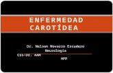 ENFERMEDAD CAROTÍDEA