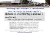 Hemorragia intrahepática e adrenal como uma rara causa de anemia neonatal