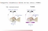 T omografía  V olumétrica  D ental de haz cónico (TVDHC)