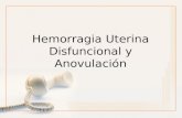 Hemorragia Uterina Disfuncional y Anovulación