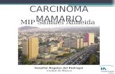 CARCINOMA MAMARIO