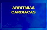 ARRITMIAS CARDIACAS EEF RF MAPEOS