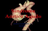 Síndrome  Aórtico  A gudo  (SAA )