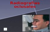 Radiografías oclusales