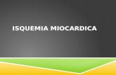 Isquemia MIOCARDICA
