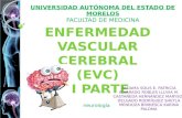 Enfermedad Vascular Cerebral ( evc ) Ii  parte