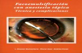 Facoemulsificación con anestesia tópica