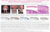 SEUDOLINFOMA CD8+ CUTÁNEO EN PACIENTE VIH SIMULANDO SÍNDROME DE SEZARY
