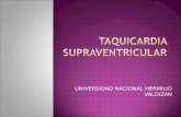 Taquicardia SV