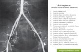 Aotograma Arterias Iliacas