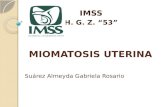 Miomatosis Uterina-hgz 53