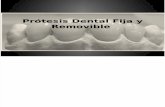 Prótesis Dental Fija y Removible