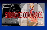 Enfermedad Vascular: Un proceso progresivo y generalizado Angina inestable SICA IM EVC/ATI isquémico Isquemia critica en piernas Muerte cardiovascular.