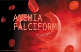 anemia falciforme .pptx