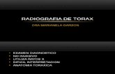 Graficos de Radiografia de Torax