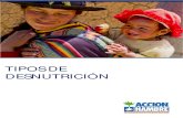 Tipos de Desnutrición -Acción contra el hambre