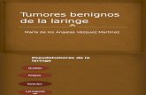 Tumores Benignos de La Laringe